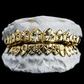 10 Gold Teeth: 10-22K Tops or Bottoms image 2