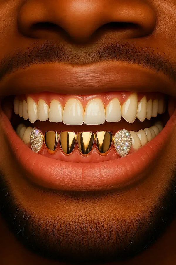 6 Gold Teeth: 2 Diamond and 4 plain image 0