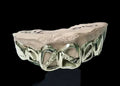 6 Silver Teeth: 6 Tops 4 Open-Bars & 2 Solid image 2