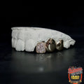 3 Gold Teeth: Stone Encrusted Tooth With 2 Solids image 2