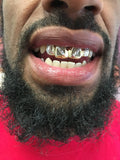 4 Gold Teeth: Open Face with Diamond Cuts image 1