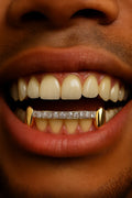 4 Teeth: Stone Encrusted Front Bar & Solid K9's image 0