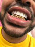Gold Front Bar: 10k 8 Piece Drip Style Grillz  image 0