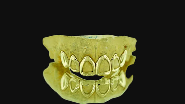 6 Teeth: 14K Gold 4 Open-Face &  2 Solid Deep Perm-cut image 1