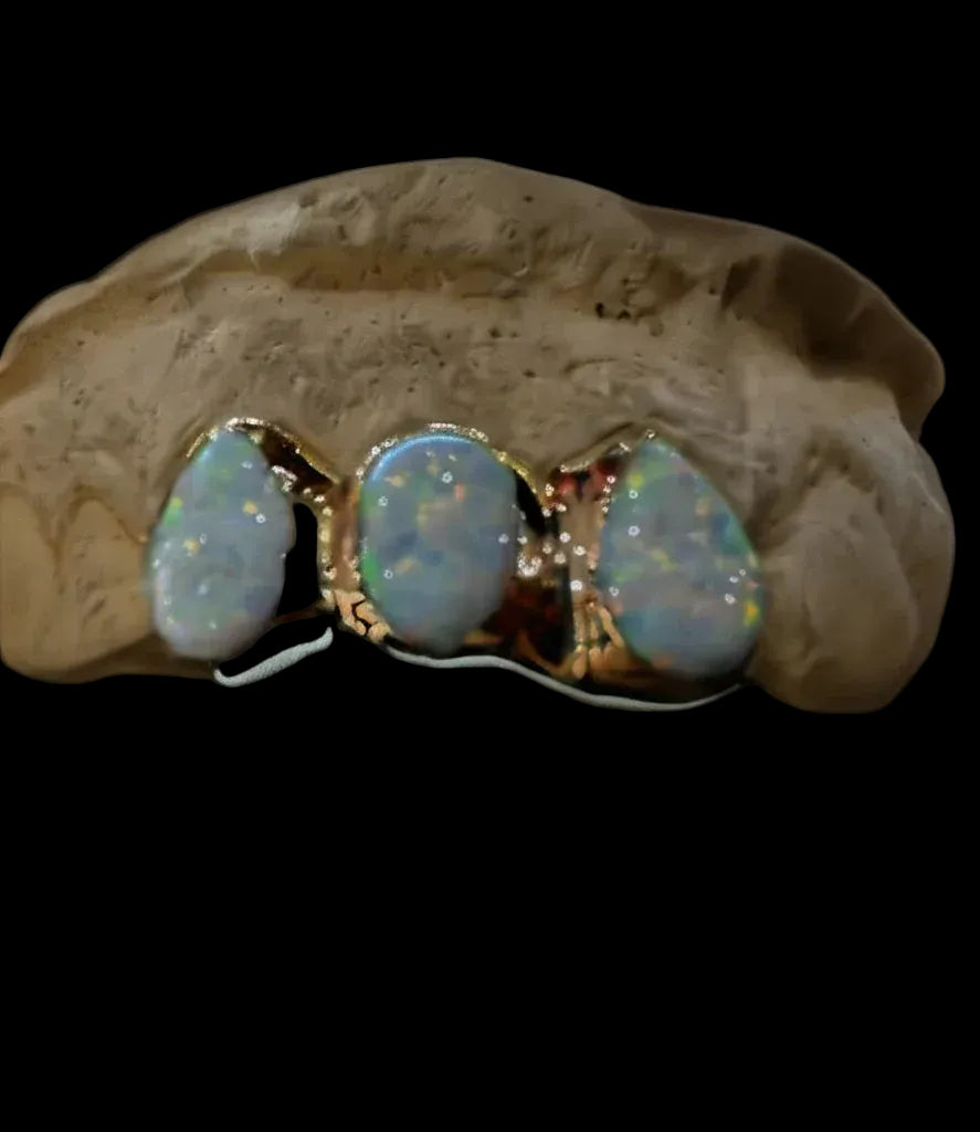 3 Gold Teeth: Triple Opal Set Fronts image 1