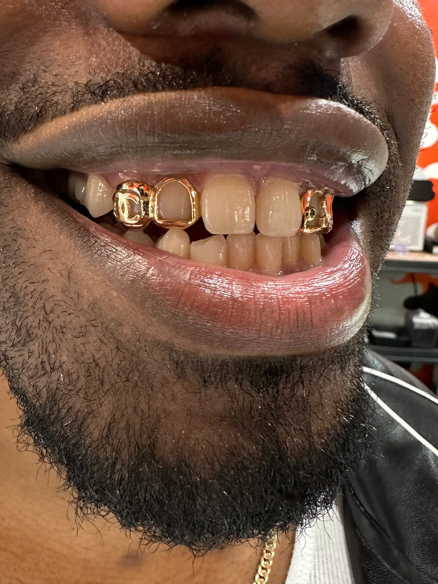 Gold Custom Set 1 image 0
