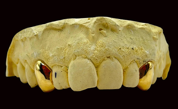 2 Gold Teeth: 22k 2 Piece With Back Bridge image 0