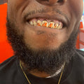 4 Gold Teeth: 10k - 22k Tops Grillz image 0