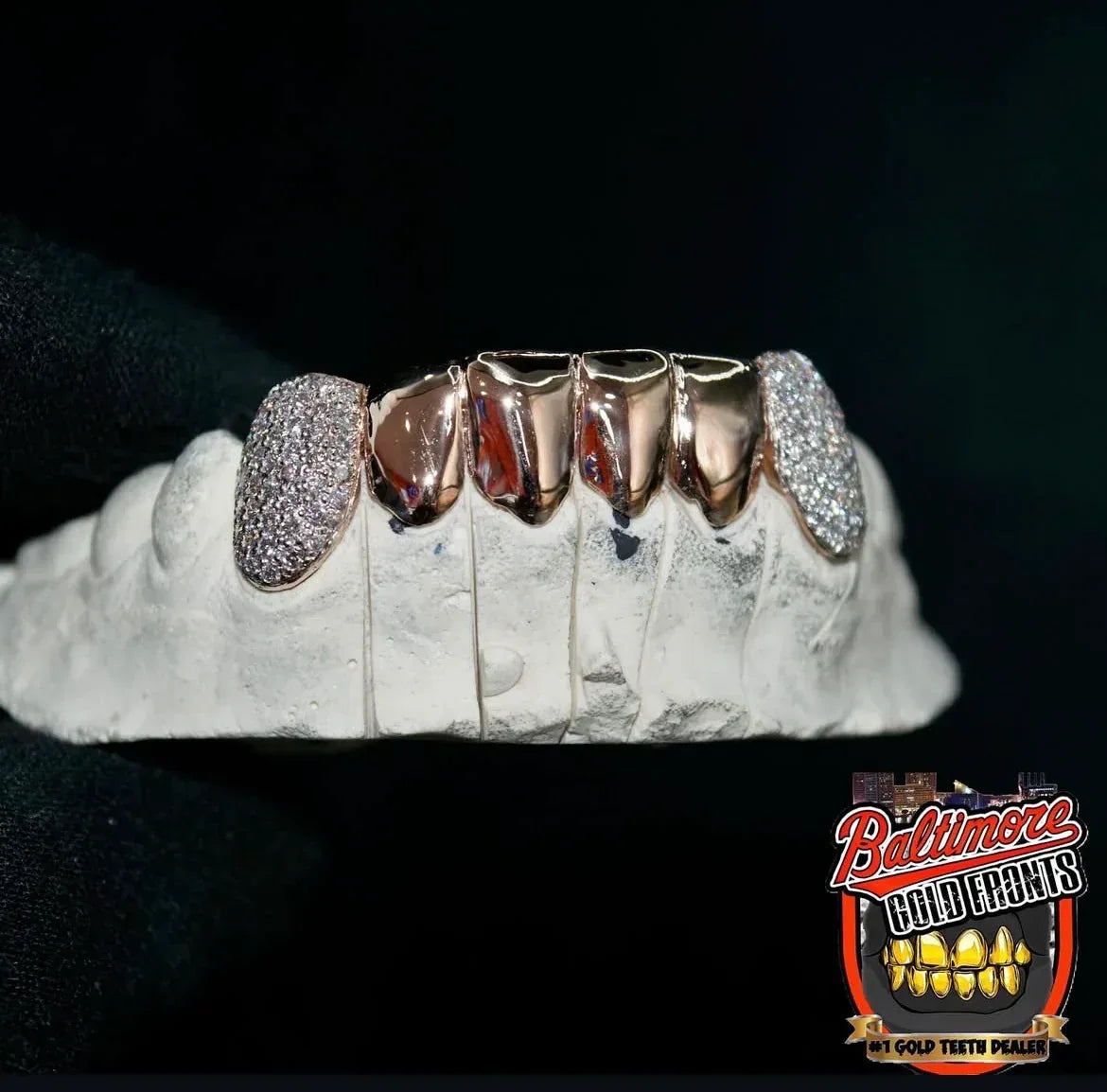 6 Gold Teeth: 2 Diamond and 4 plain image 1