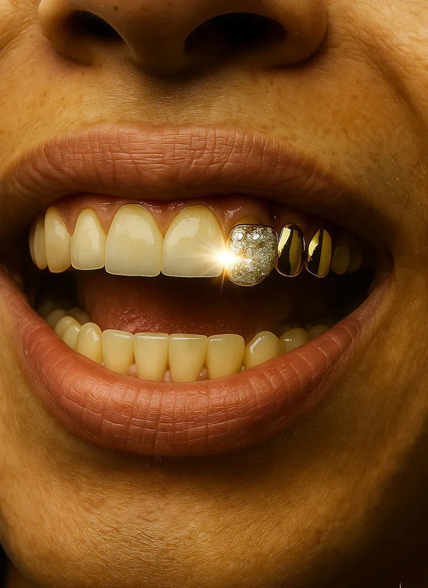3 Gold Teeth: Stone Encrusted Tooth With 2 Solids image 0