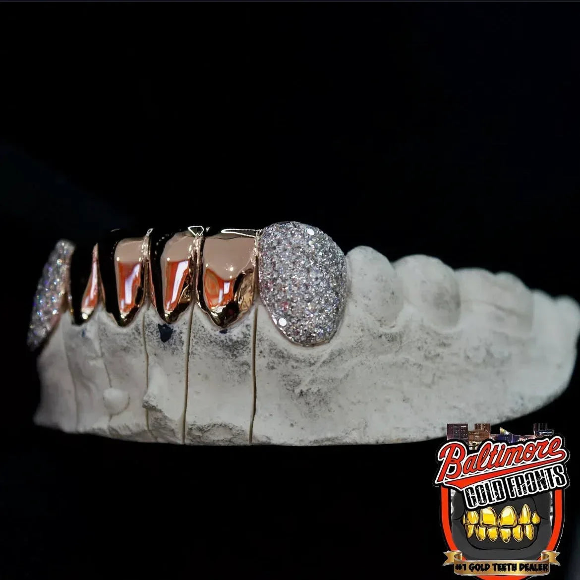 6 Gold Teeth: 2 Diamond and 4 plain image 2