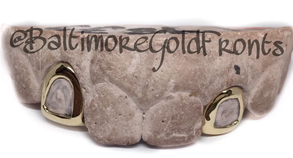 10K Gold 2 Open Face Gold Crown w/ Back Bridge image 0