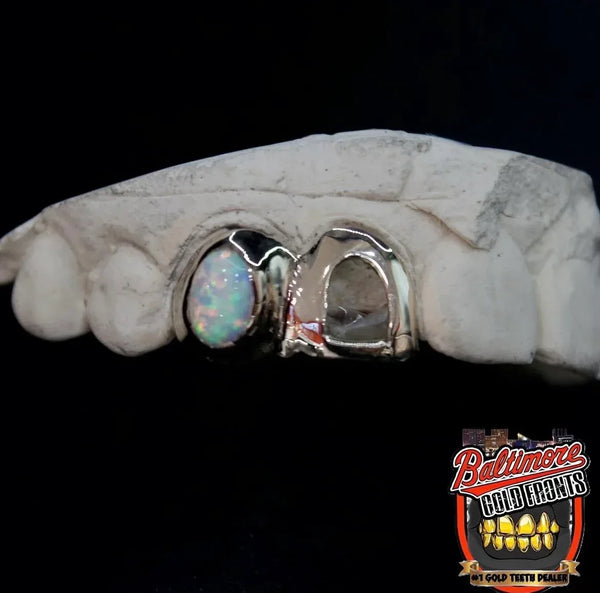 2 Teeth: Open Face and Opal image 1