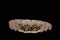 10k Gold 2 Sunshine Cuts with White Gold and 2 Open Face image 0