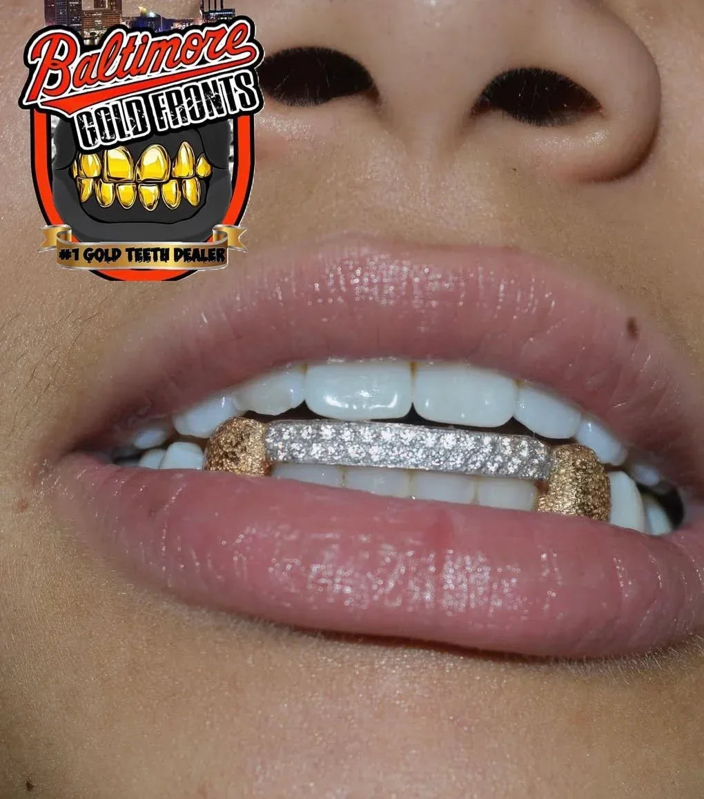 6 teeth: double bridge with 2 diamond dust k9's image 3