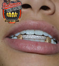6 teeth: double bridge with 2 diamond dust k9's image 3