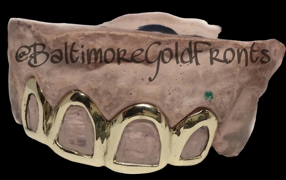 10k Gold 4 Open Face Crowns image 0