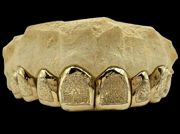 8 Gold Teeth: 10k Yellow Gold 8 Piece With Diamond Dust image 0