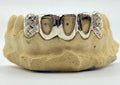 5 Gold Teeth: 10k White Gold 2 Diamond Dust & Cutz With 3 Open Face image 0