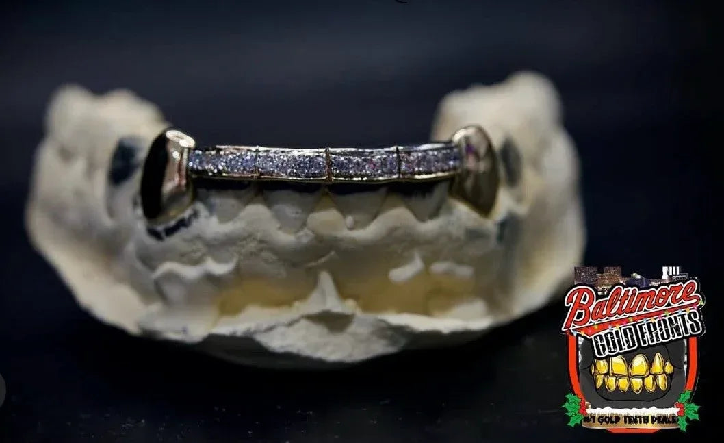 4 Teeth: Stone Encrusted Front Bar & Solid K9's image 1