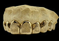 8 Gold Teeth: 10k Yellow Gold 8 Piece With Diamond Dust image 2