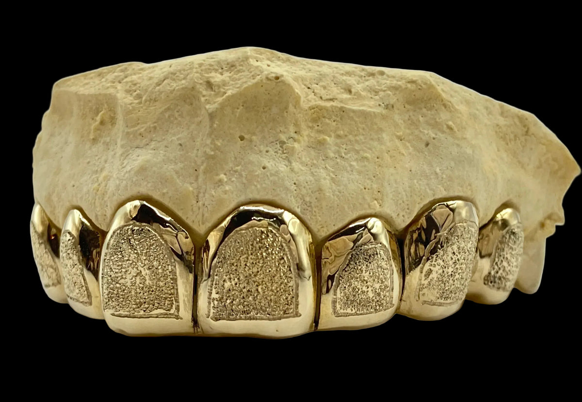 8 Gold Teeth: 10k Yellow Gold 8 Piece With Diamond Dust image 2