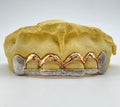 6 Gold Teeth: 10k Gold Open Face With Diamond Cutz image 0