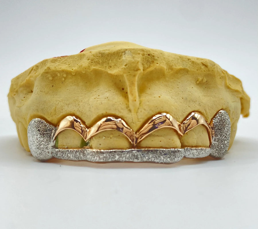 6 Gold Teeth: 10k Gold Open Face With Diamond Cutz image 0