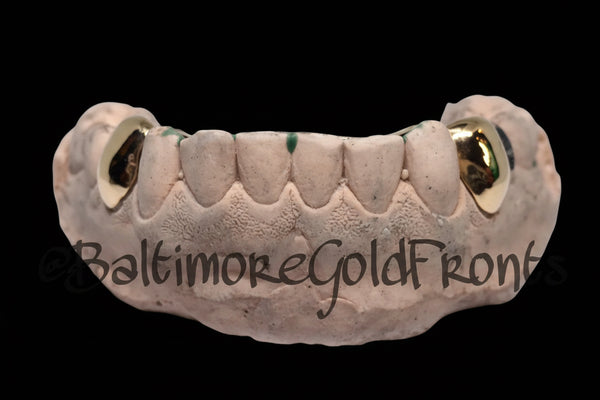 10k Gold 2 Solids w/ Back Bridge Gold image 0