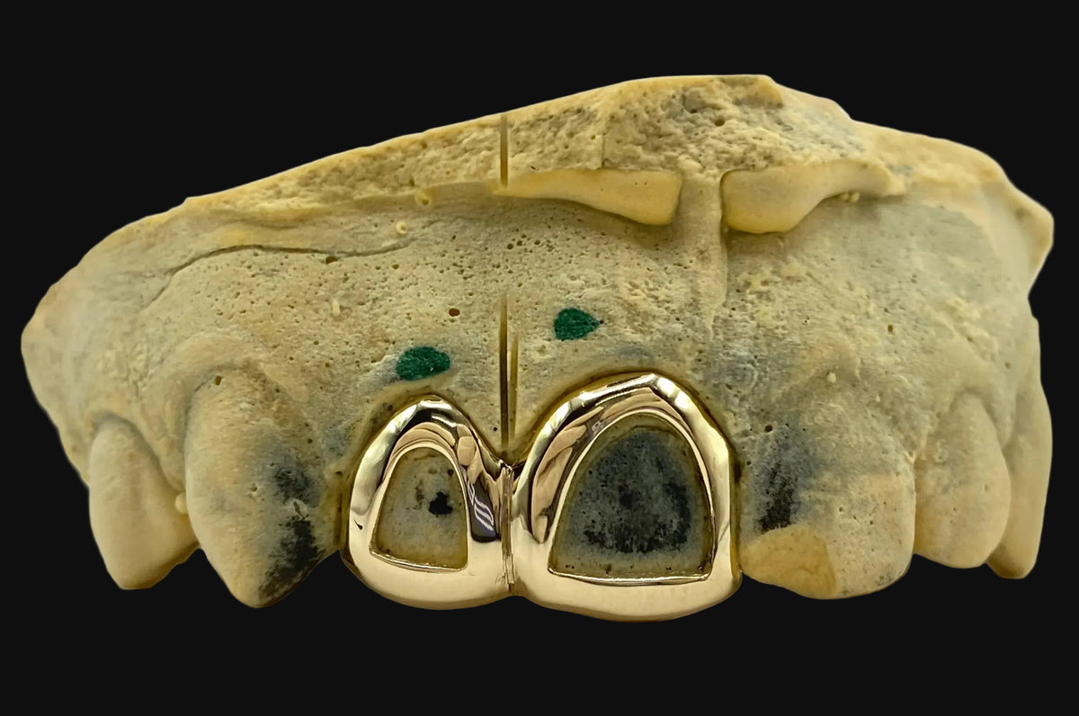 2 Gold Teeth: 14K 2 Piece Open Face image 0