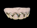 10K Gold 4 Open-Face & 2 Plain Solid Deep-cut Permit  image 0