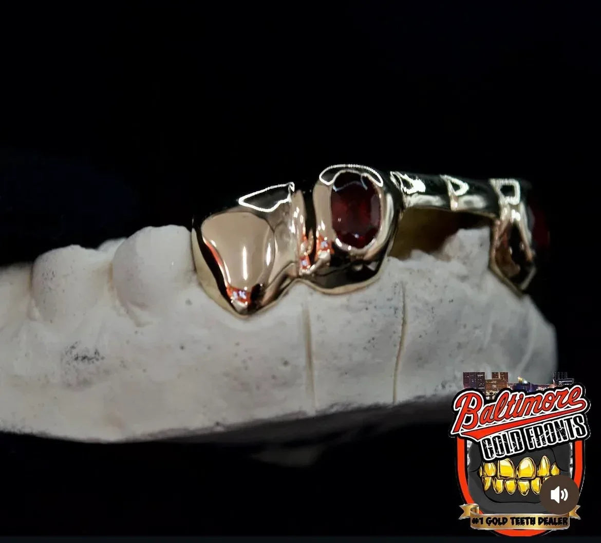 5 Gold Teeth: Front Bridge with Ruby incisors image 2