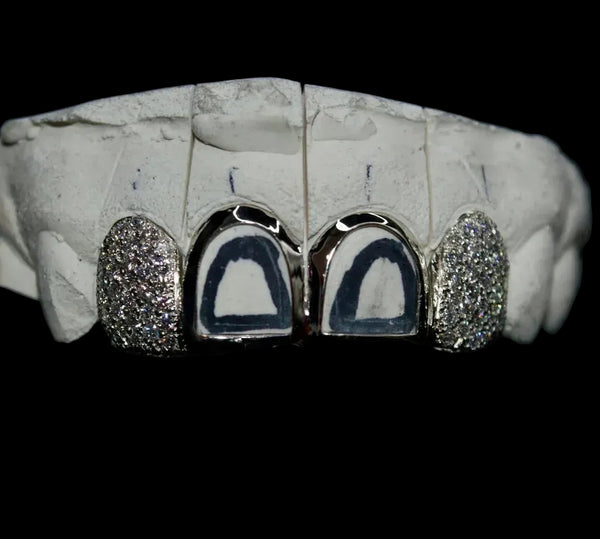 4 Teeth: 2 piece with 2 open faces image 1