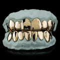 10 Gold Teeth: 10-22K Tops or Bottoms image 1