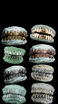 8 Gold Teeth: Top or Bottoms 10K-22K Gold image 8
