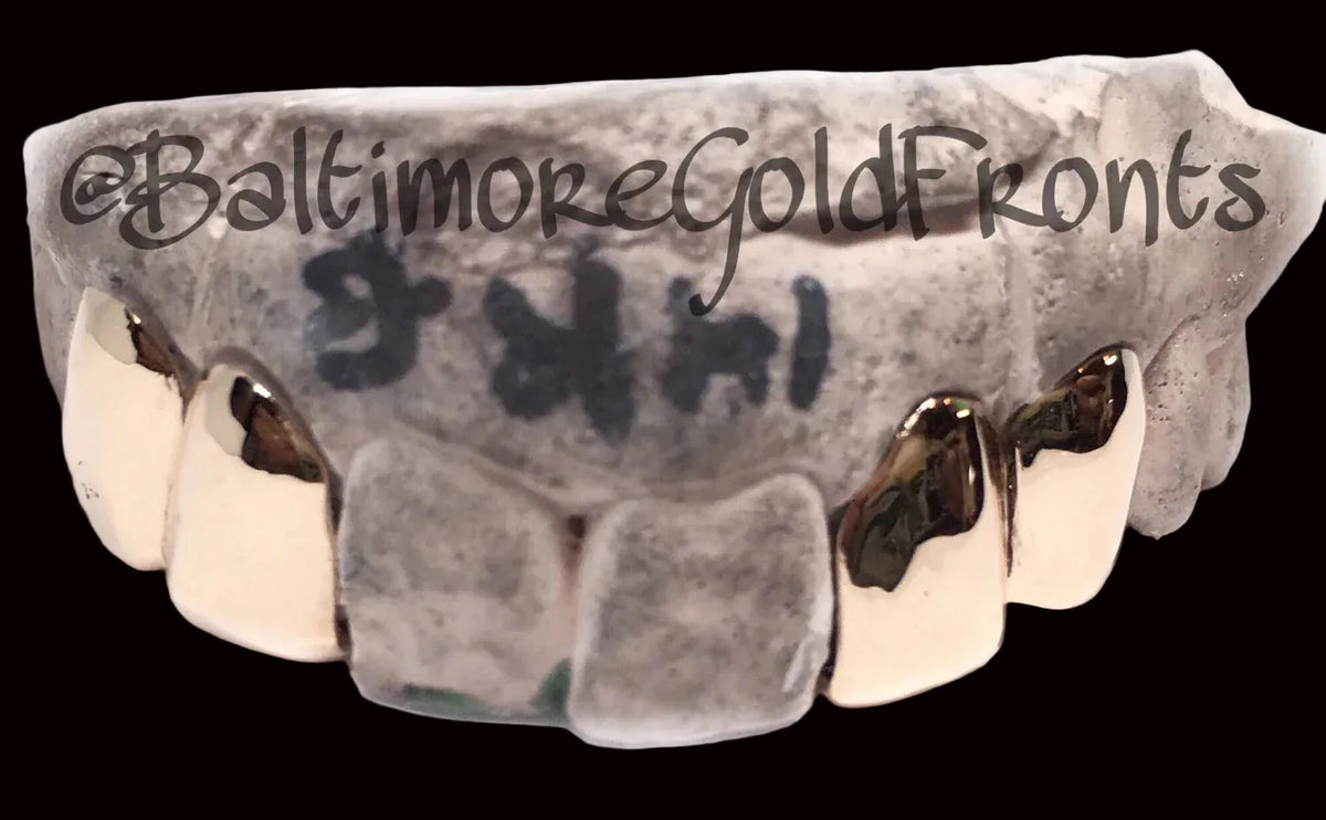 10k Gold 4 Solid Plain w/ Back Bridge image 0