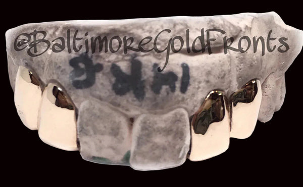 10k Gold 4 Solid Plain w/ Back Bridge image 0