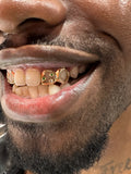 Gold Custom Set 1 image 1