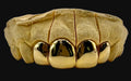 4 Gold Teeth: 10k - 22k Tops Grillz image 1