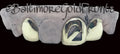 10k Gold 2 Solid 1 Open Face Slash w/ Back Bridge image 0