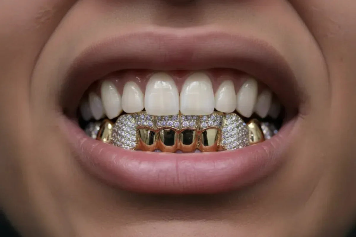 8 Gold Teeth: Stone Encrusted Piece Front Bar with K9's image 0