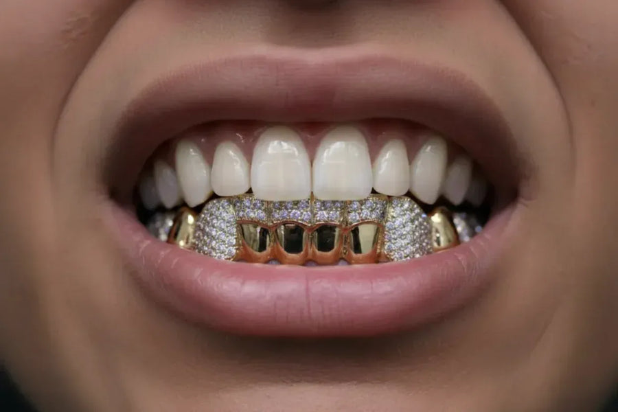 8 Gold Teeth: Stone Encrusted Piece Front Bar with K9's image 0