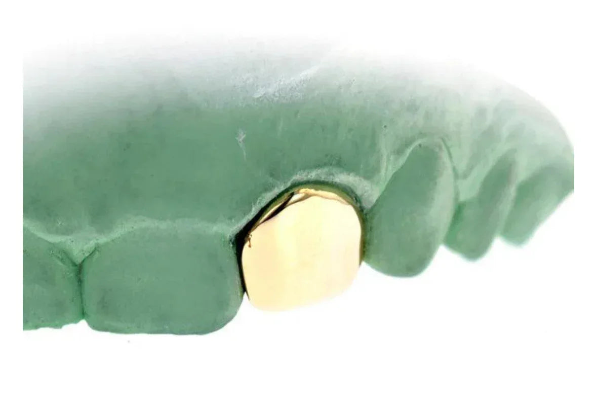 1 Gold Tooth "SINGLE CAP": TOP OR BOTTOM 10K-22K image 2