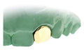 1 Gold Tooth "SINGLE CAP": TOP OR BOTTOM 10K-22K image 2