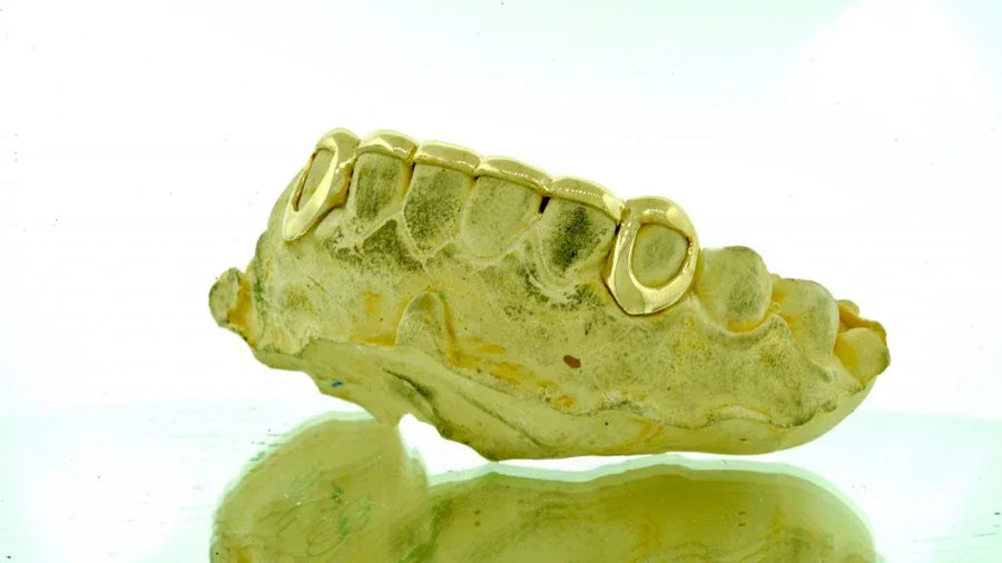 2 Gold Teeth: 14K 2 K9's w/ Front Bridge image 0