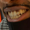1 Gold Tooth: 14k Cut Out Single Cap Any Color Gold image 1