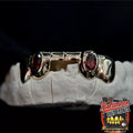 5 Gold Teeth: Front Bridge with Ruby incisors image 1