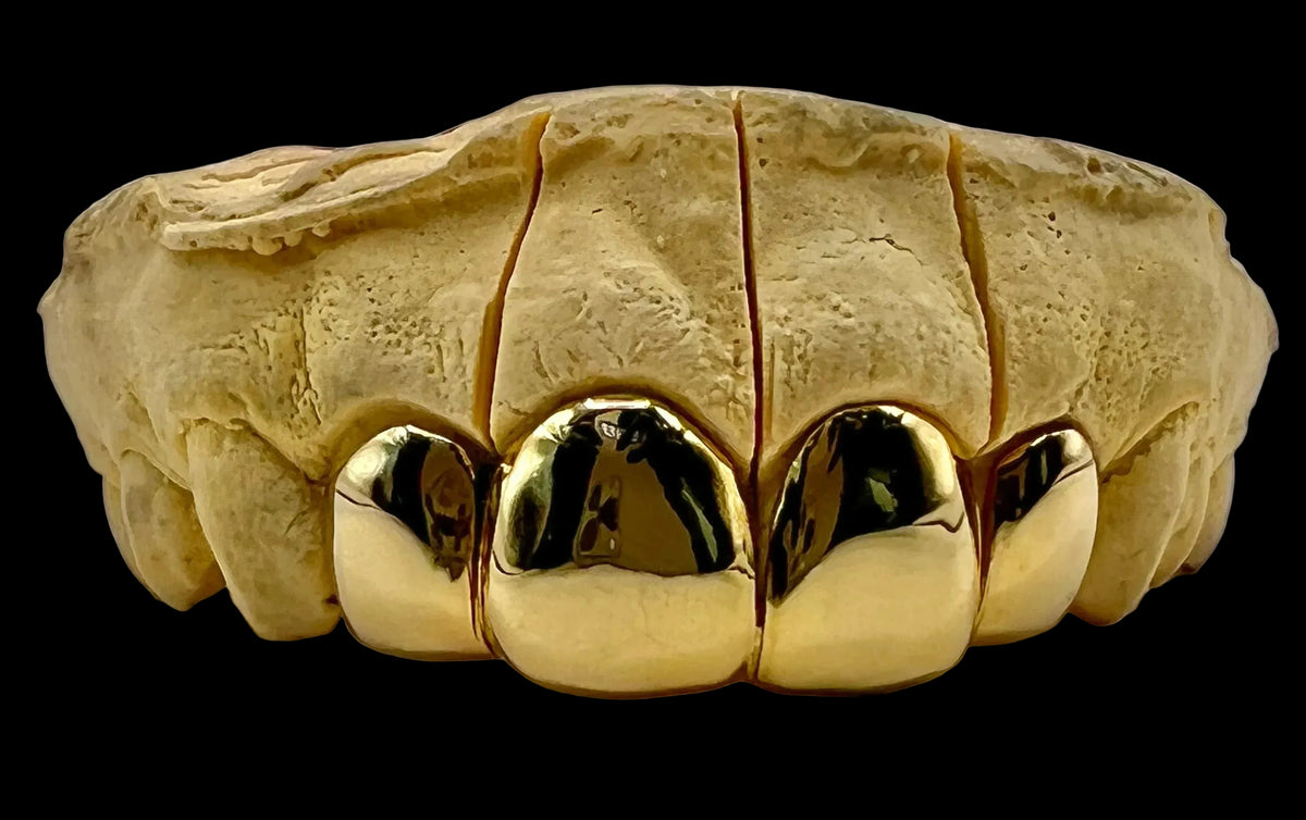 4 Gold Teeth: 10k Gold image 1