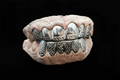 12 pcs 6 Tops & 6 Bottom Set with Diamond Cuts
