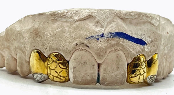 4 Gold Teeth: 14k 2 Nugget Cut 2 Solid W/ Diamond Cutz Edge and Back Bridge image 0